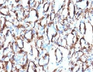 Anti-Alpha Smooth Muscle Actin Antibody, Sodium Azide Free