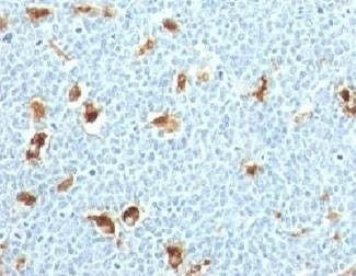 Anti-S100A9 Antibody, Sodium Azide Free