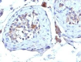 Anti-SHBG Antibody