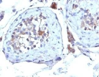 Anti-SHBG Antibody, Sodium Azide Free