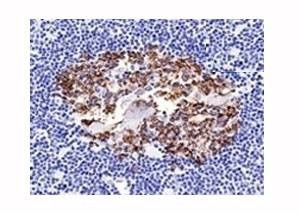 Anti-CDw75 Antibody, Sodium Azide Free