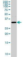 Anti-AQP8 Antibody