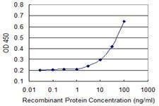Anti-AQP8 Antibody