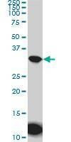 Anti-AQP8 Antibody