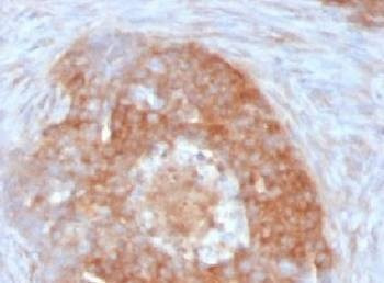 Anti-Fascin Antibody, Sodium Azide Free
