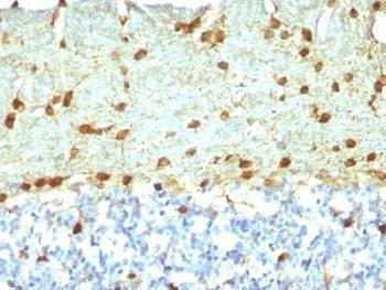 Anti-Fascin Antibody