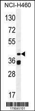 Anti-BSCL2 (N-term) Antibody