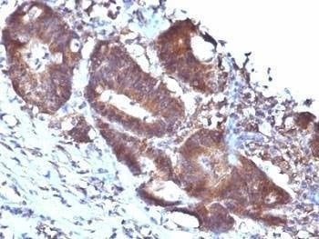 Anti-SM22 alpha Antibody