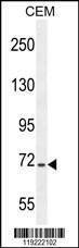 Anti-STIM1 (C-term) Antibody