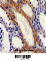 Anti-STIM1 (C-term) Antibody