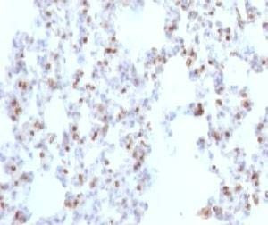 Anti-TTF1 Antibody
