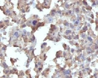 Anti-TNF-alpha Antibody