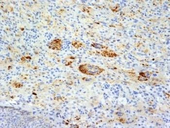 Anti-TNF-alpha Antibody