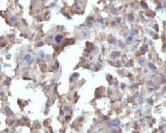 Anti-TNF-alpha Antibody, Sodium Azide Free