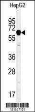 Anti-IGF2BP2 (C-term) Antibody