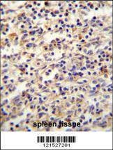 Anti-IGF2BP2 (C-term) Antibody
