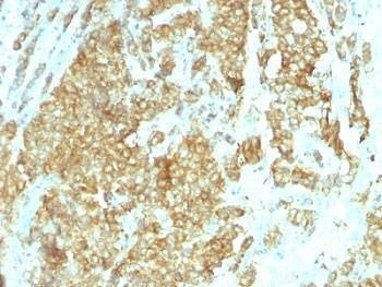 Anti-GRP94 Antibody