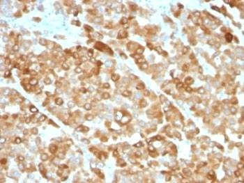 Anti-Tyrosinase Antibody (TYR), Sodium Azide Free