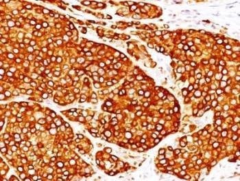 Anti-TYR Antibody Cocktail (Tyrosinase)