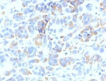 Anti-TYRP1 Antibody (TRP), Sodium Azide Free
