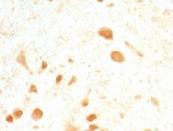 Anti-PGP 9.5 Antibody, Sodium Azide Free