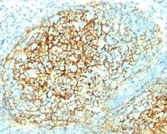 Anti-VCAM-1 Antibody, Sodium Azide Free
