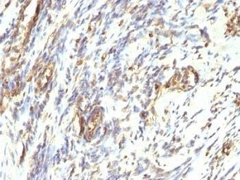 Anti-Vimentin Antibody