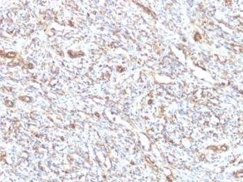 Anti-Vimentin Antibody