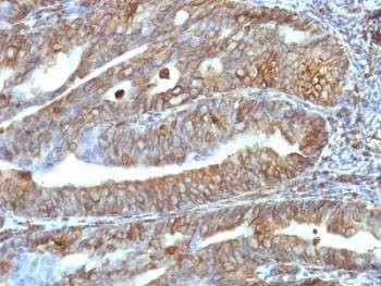Anti-Vimentin Antibody