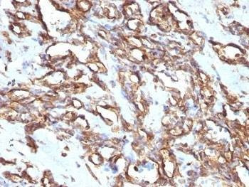Anti-Vimentin Antibody, Sodium Azide Free
