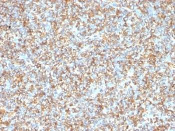 Anti-Vimentin Antibody, Sodium Azide Free
