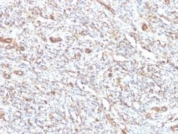 Anti-Vimentin Antibody, Sodium Azide Free