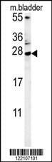 Anti-MUTED (Center) Antibody
