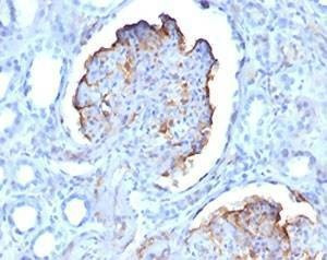 Anti-WT1 Antibody Cocktail