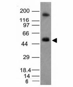 Anti-CAIX Antibody, Sodium Azide Free