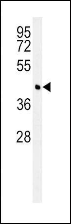 Anti-BCAT1 (Center) Antibody