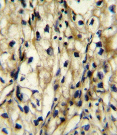 Anti-BCAT1 (Center) Antibody