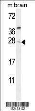 Anti-TIMP4 (Center) Antibody