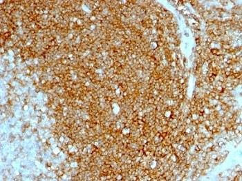 Anti-HCAM Antibody