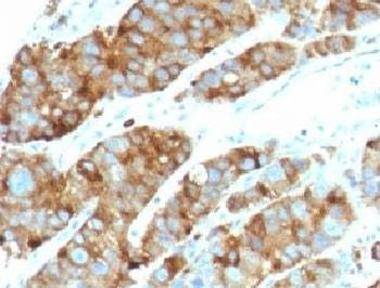 Anti-LAMP3 Antibody