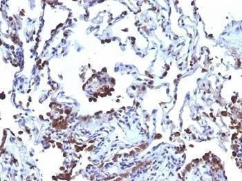 Anti-CD63 Antibody Cocktail