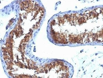 Anti-Major Vault Protein Antibody