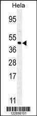Anti-FOXL2 (N-term) Antibody