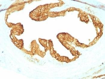 Anti-pan Cytokeratin Antibody