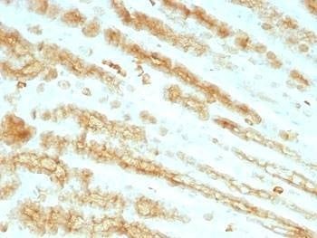 Anti-pan Cytokeratin Antibody