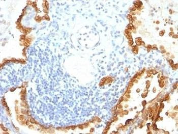 Anti-Cytokeratin 8 + 18 Antibody Cocktail, Sodium Azide Free