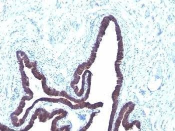 Anti-Cytokeratin 8 + 18 Antibody Cocktail, Sodium Azide Free