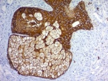 Anti-pan Cytokeratin Antibody Cocktail, Sodium Azide Free