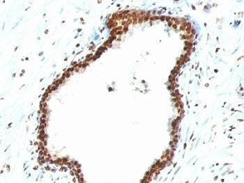 Anti-dsDNA Antibody