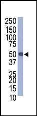 Anti-Protein-C Tag Antibody